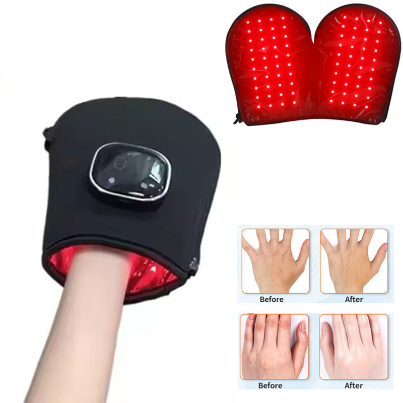 Heated Gloves Electric - YENİ Kırmızı Işık Terapi Cihazı Eller